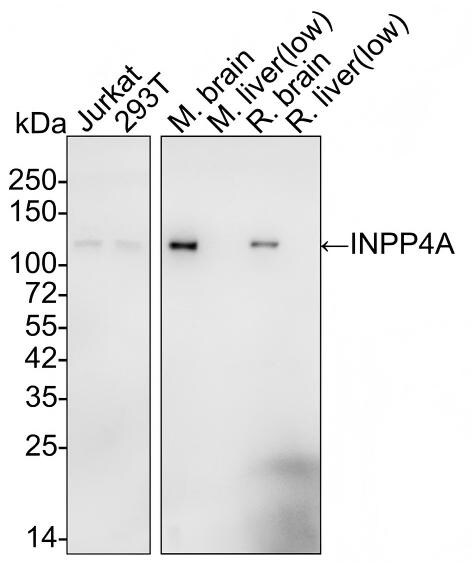 INPP4A Antibody (PSH01-27) Western Blot: INPP4A Antibody (PSH01-27) [NBP3-32474]