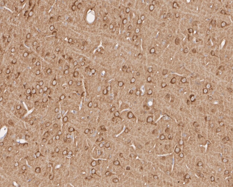 INPP4A Antibody (PSH01-27)