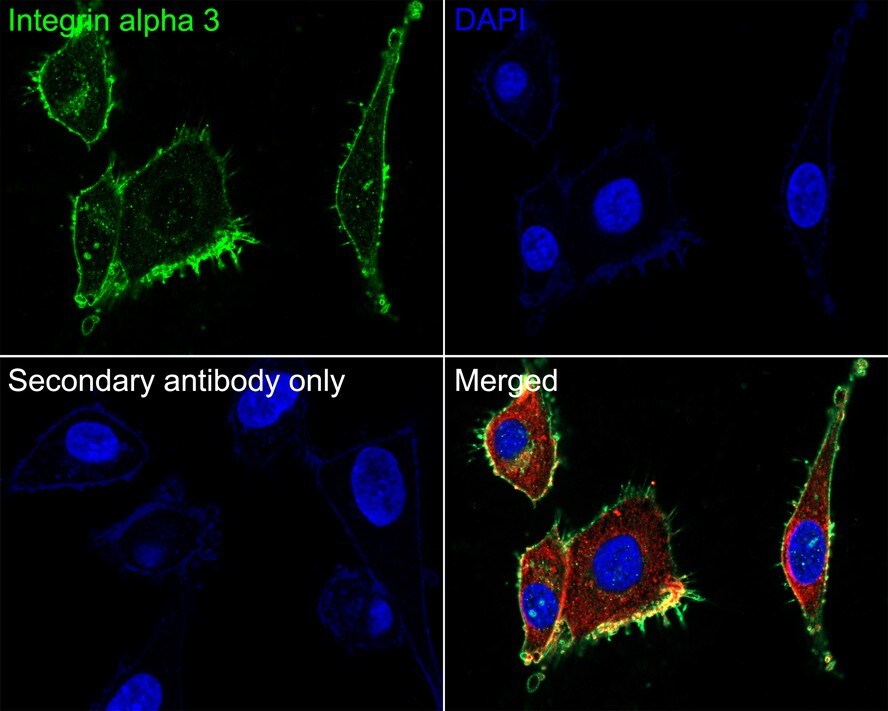 Integrin alpha 3/CD49c Antibody (A7H2)