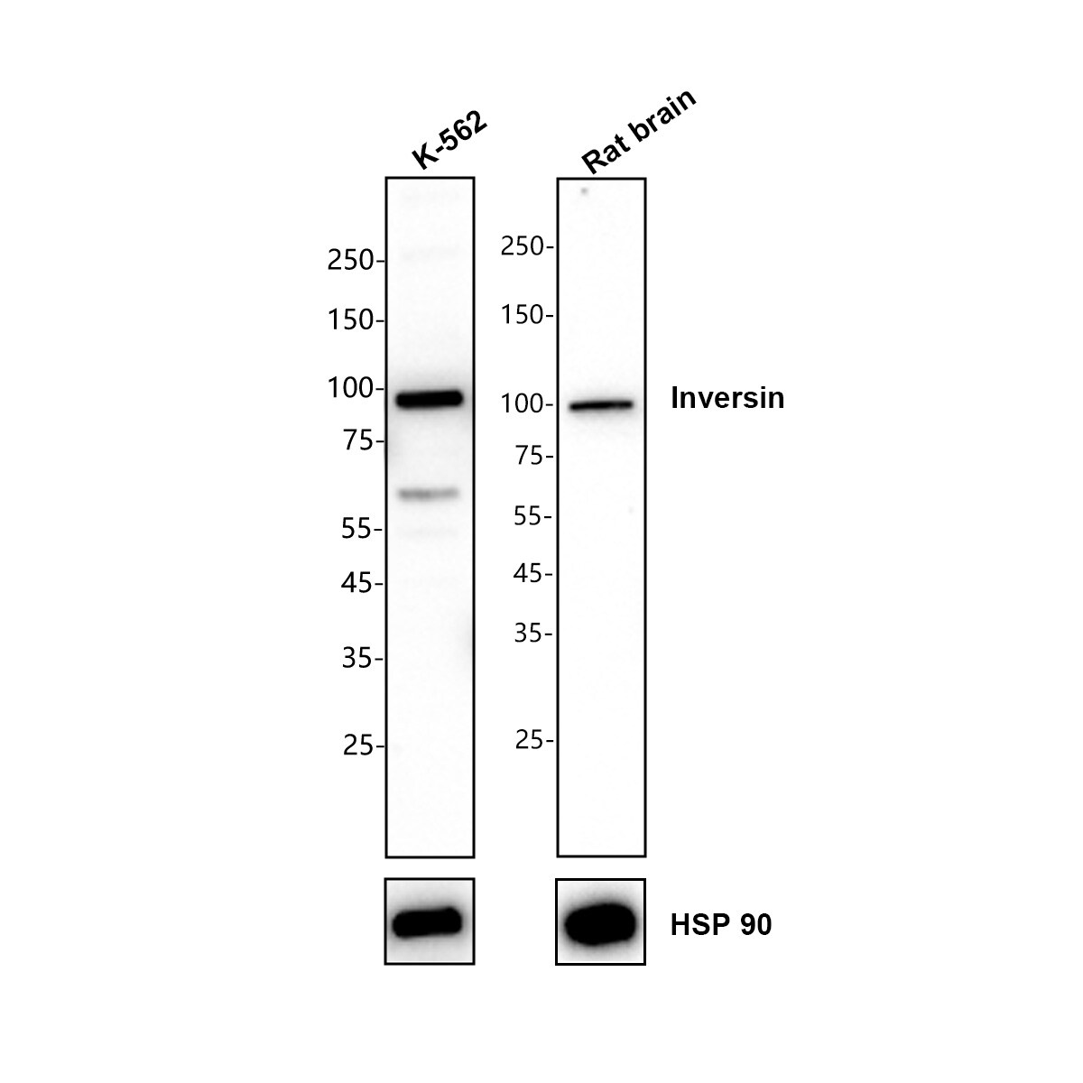 Inversin Antibody Western Blot: Inversin Antibody [NBP3-32477]