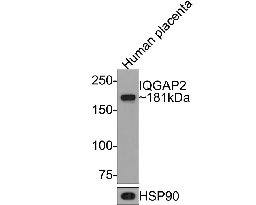IQGAP2 Antibody (JE64-54)