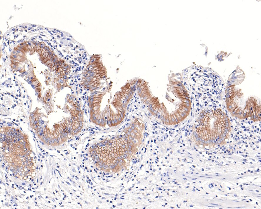 IQGAP2 Antibody (JE64-54)
