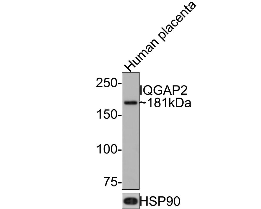 IQGAP2 Antibody (JE64-93) Western Blot: IQGAP2 Antibody (JE64-93) [NBP3-32481]
