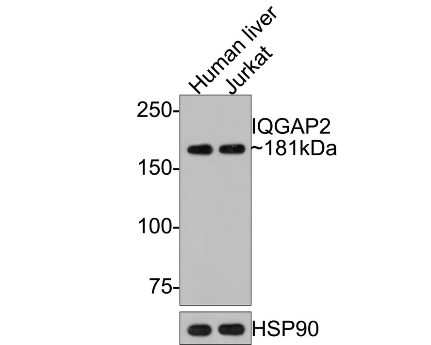 IQGAP2 Antibody (JE64-93) Western Blot: IQGAP2 Antibody (JE64-93) [NBP3-32481]