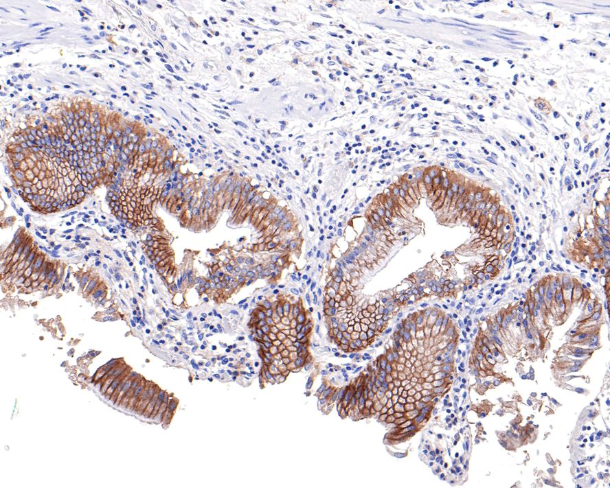 IQGAP2 Antibody (JE64-93)