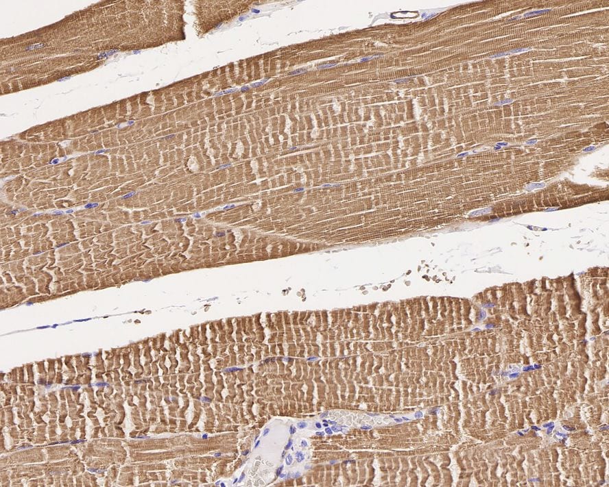 IRAK4 Antibody (JE41-77)