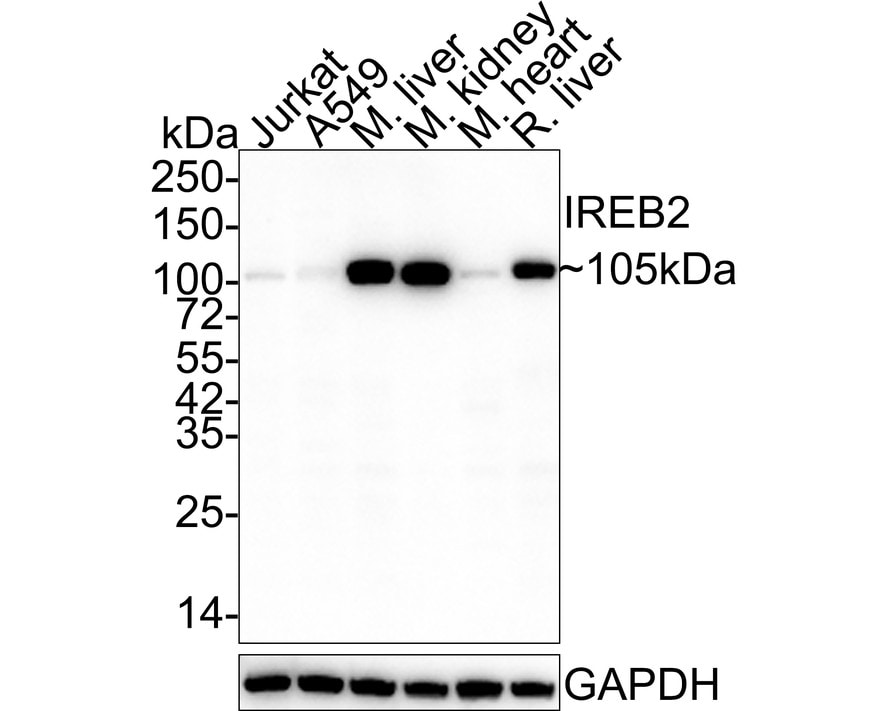 IRP2 Antibody (9D1-R) Western Blot: IRP2 Antibody (9D1-R) [NBP3-32483]