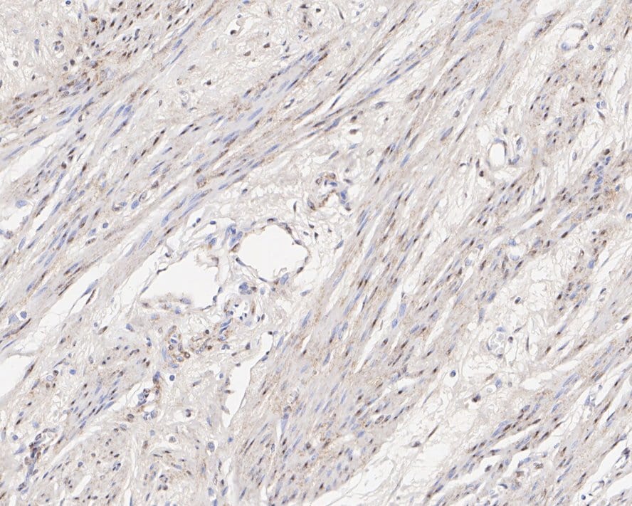 Jumonji/JARID2 Antibody (PSH01-32)