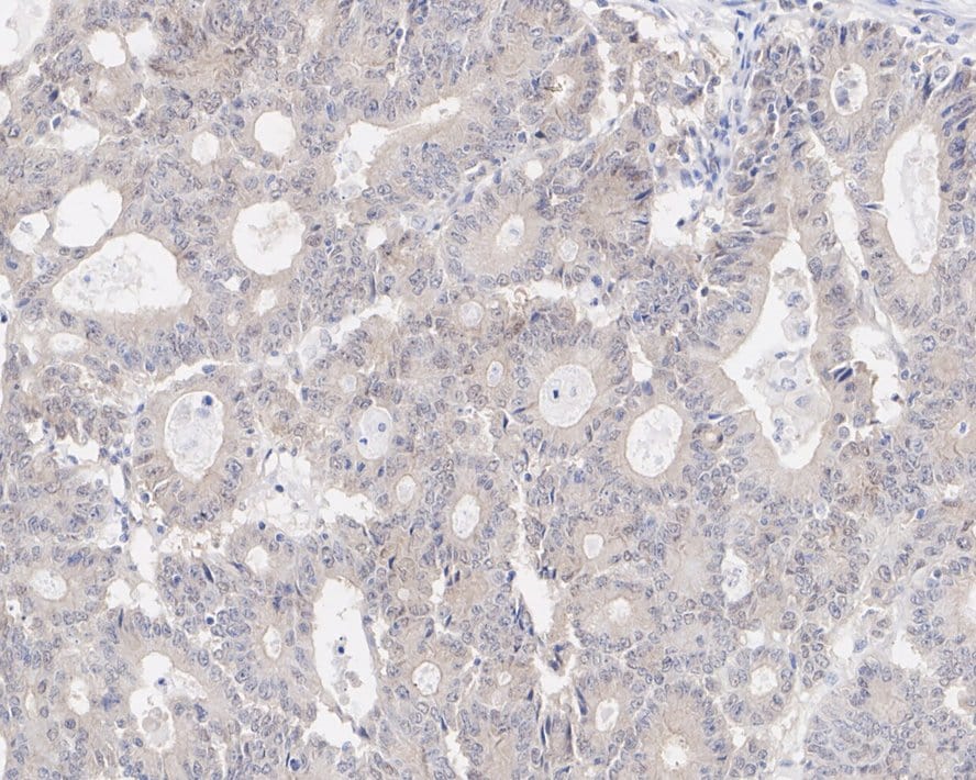 JNK1 Antibody (JE63-04)