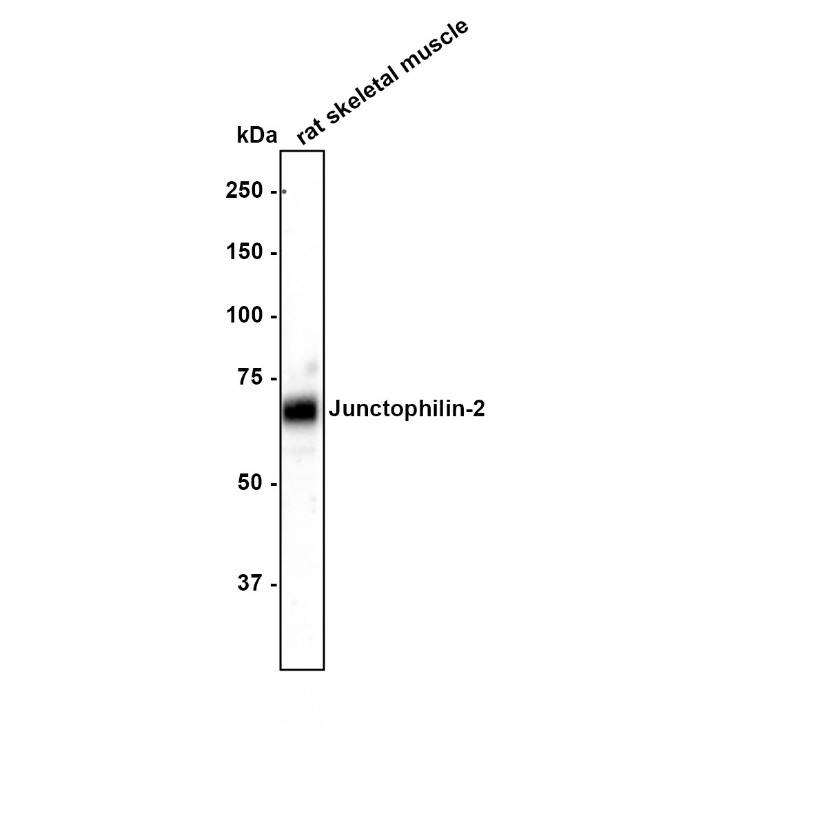 JPH2 Antibody (3-2-R) Western Blot: JPH2 Antibody (3-2-R) [NBP3-32488]