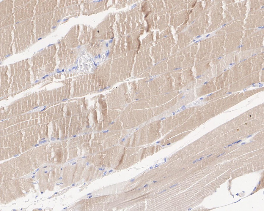 JPH2 Antibody (3-2-R)