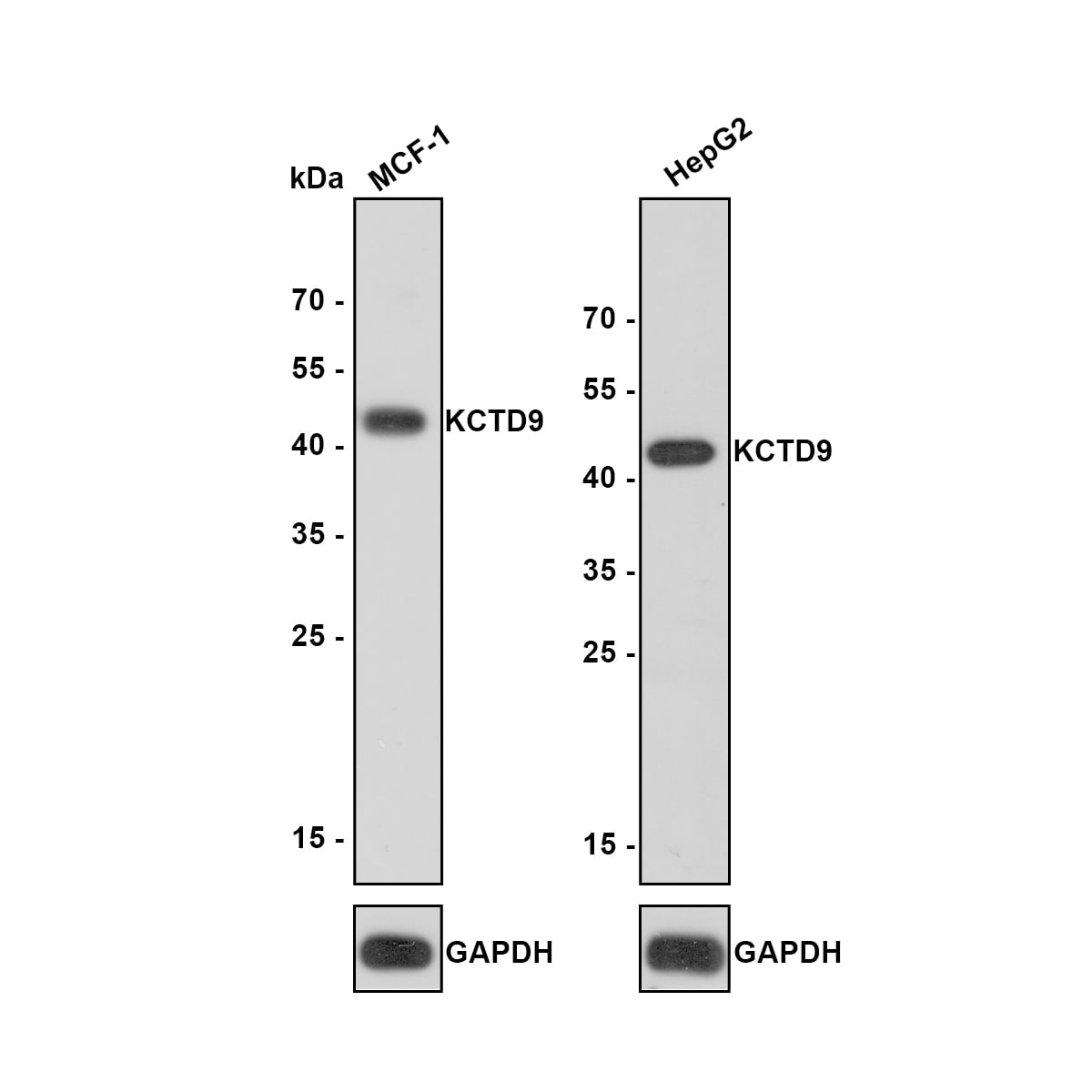 KCTD9 Antibody (JE64-67) Western Blot: KCTD9 Antibody (JE64-67) [NBP3-32489]
