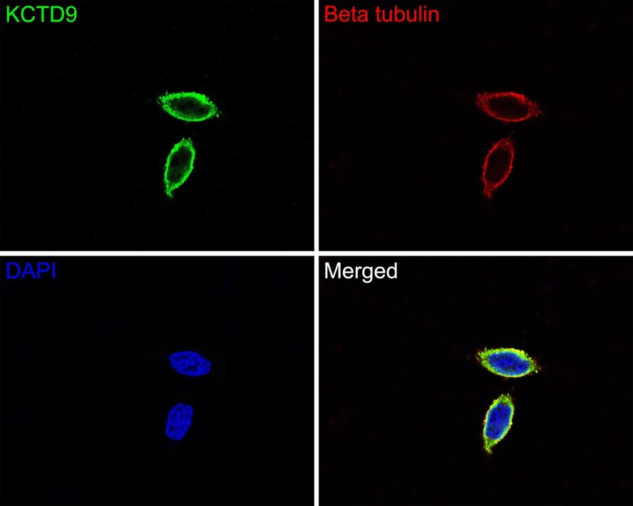 KCTD9 Antibody (JE64-67)