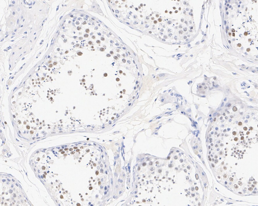 Lysine (K)-specific Demethylase 3A/KDM3A/JMJD1A Antibody (PSH01-77)