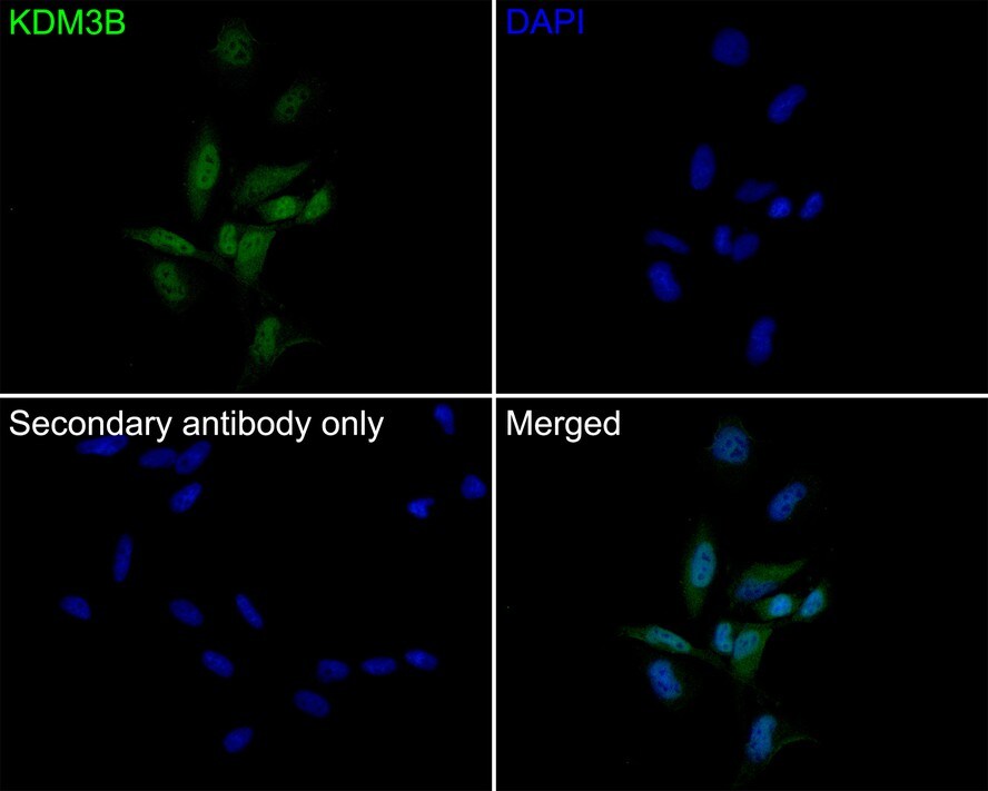 JMJD1B Antibody (1A8)