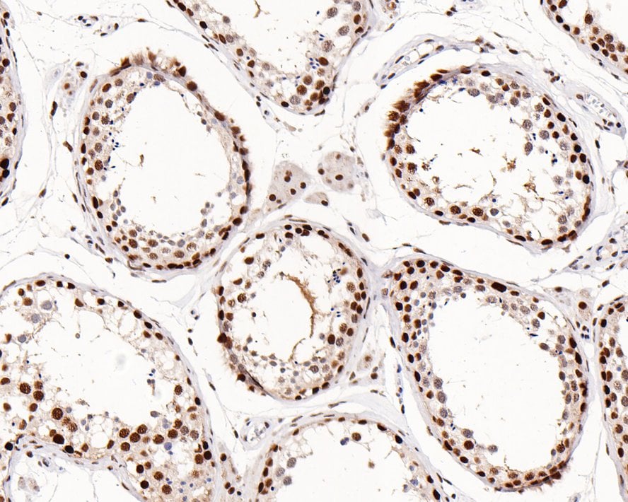JMJD1B Antibody (1A8)