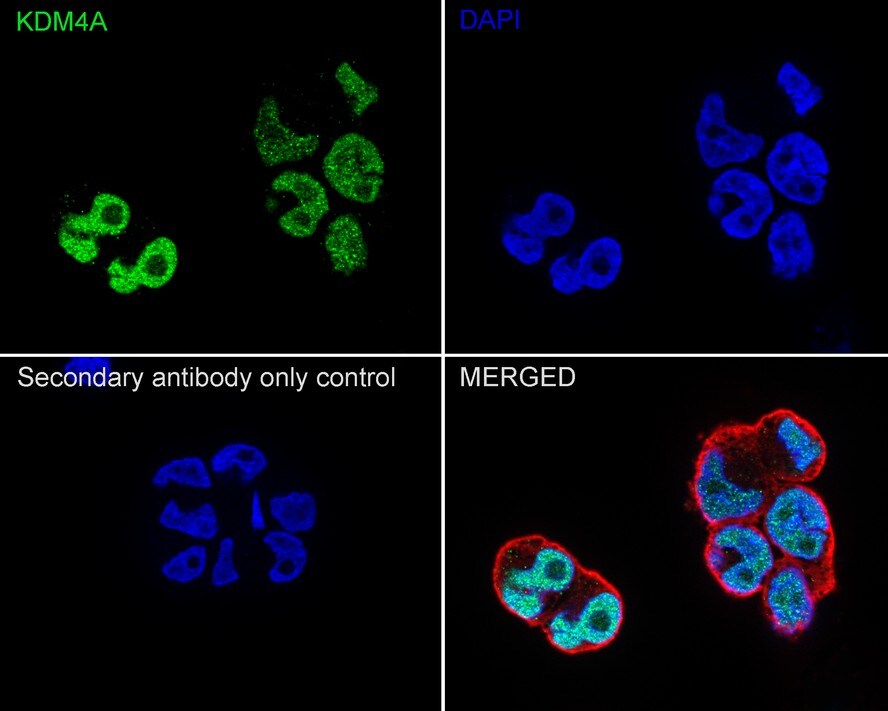 Lysine (K)-specific Demethylase 4A/KDM4A/JMJD2A Antibody (PSH03-67)