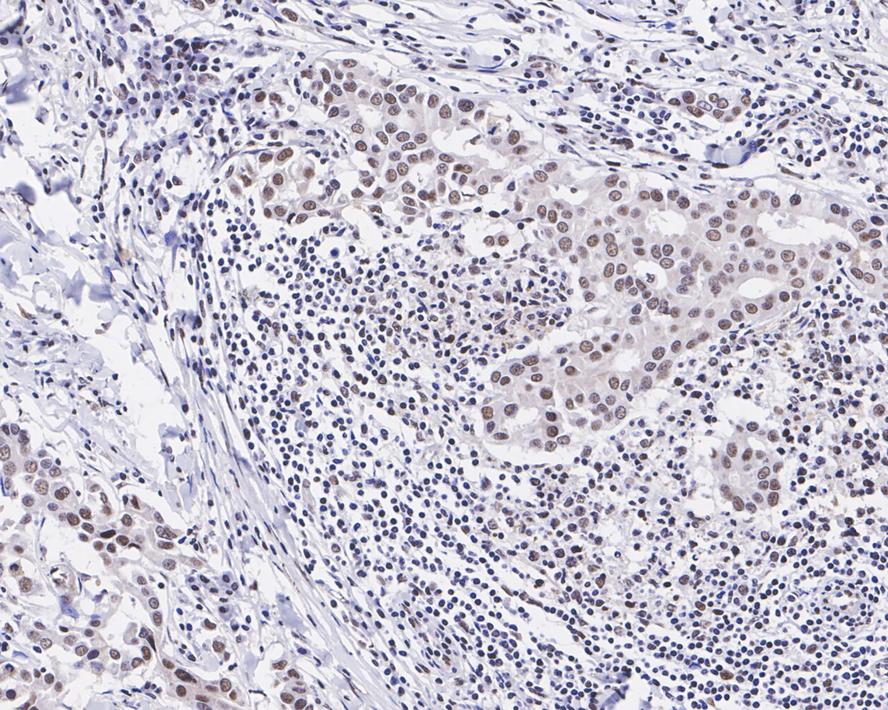 JMJD2B Antibody (JE36-58)