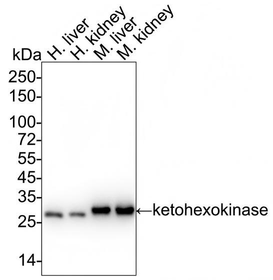 Ketohexokinase Antibody (PSH03-18) Western Blot: Ketohexokinase Antibody (PSH03-18) [NBP3-32496]