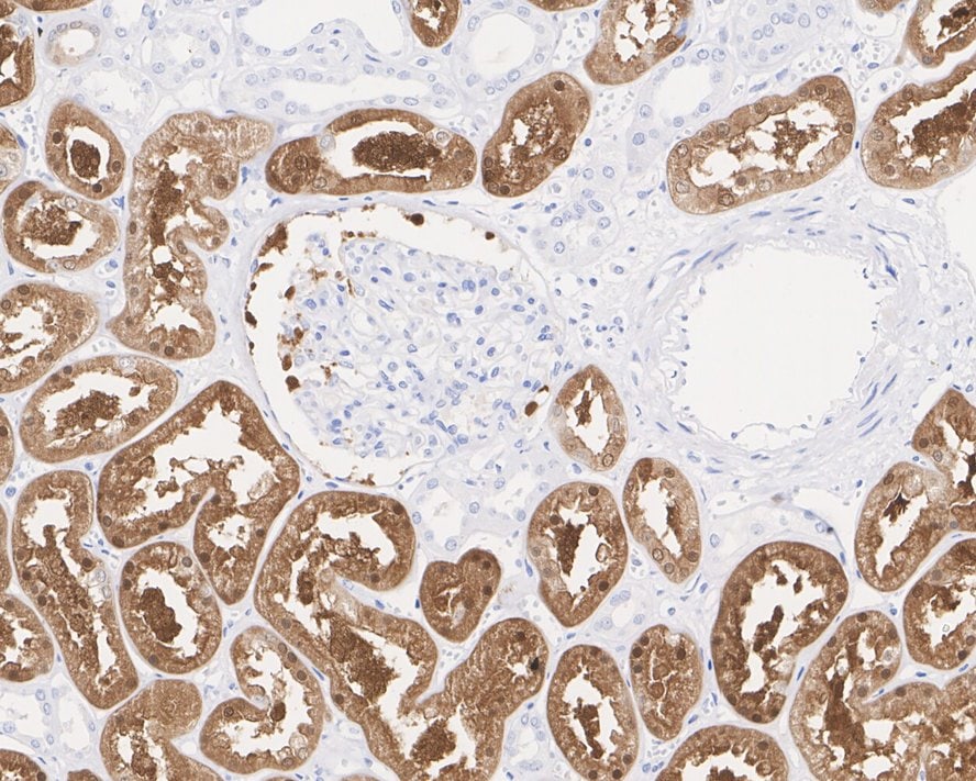 Ketohexokinase Antibody (PSH03-18)