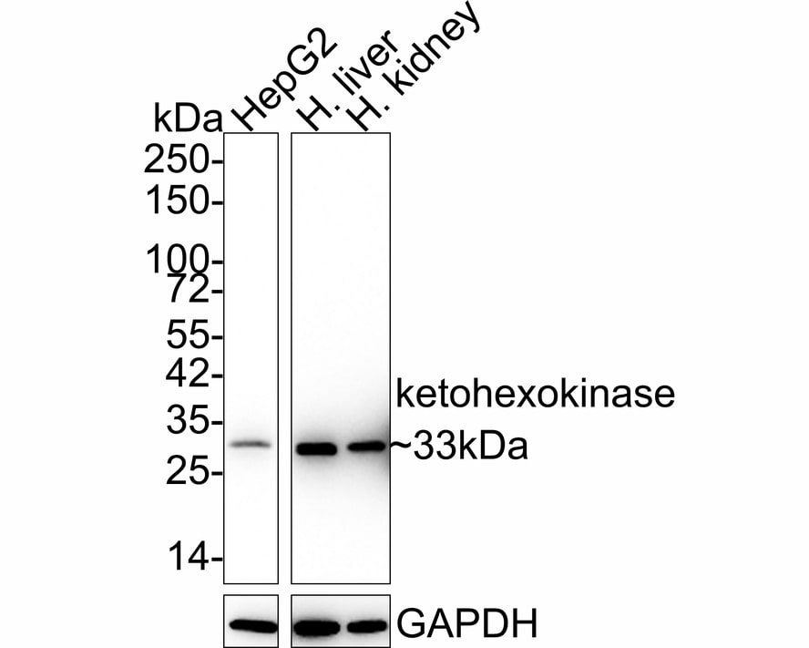Ketohexokinase Antibody (PSH03-19) Western Blot: Ketohexokinase Antibody (PSH03-19) [NBP3-32497]