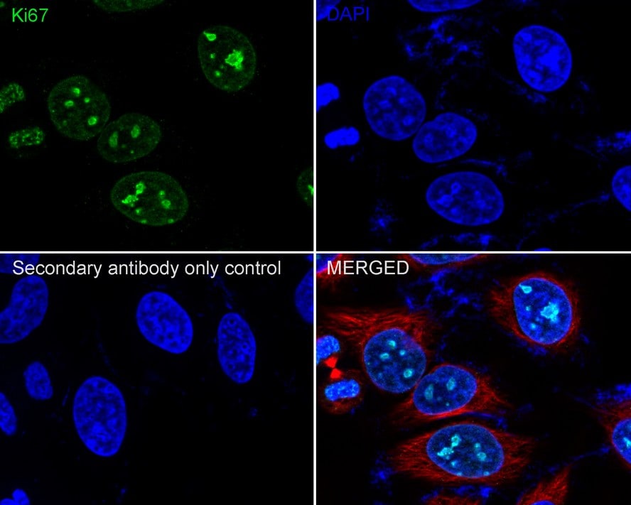 Ki67/MKI67 Antibody (SR00-02)