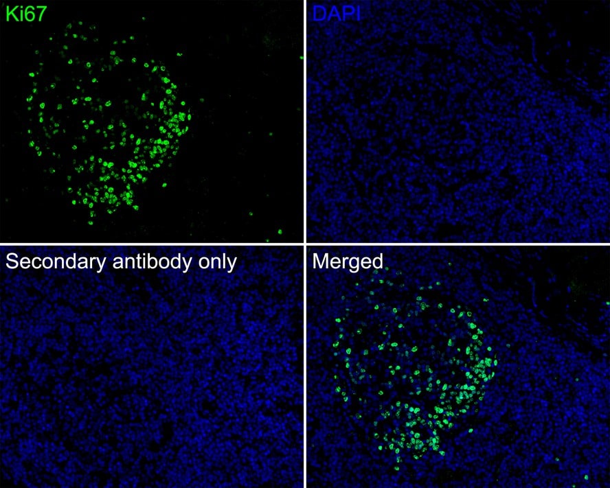 Ki67/MKI67 Antibody (SR00-02)