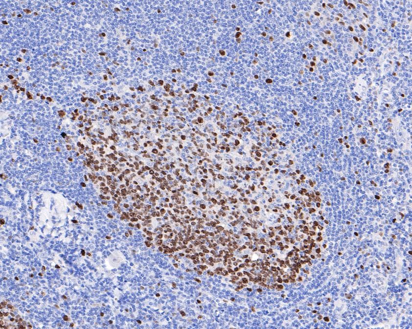 Ki67/MKI67 Antibody (SR00-02)