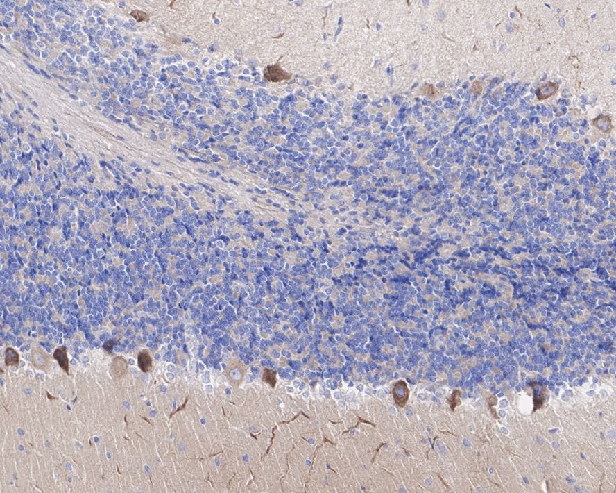 KIF3A Antibody (JE31-39)