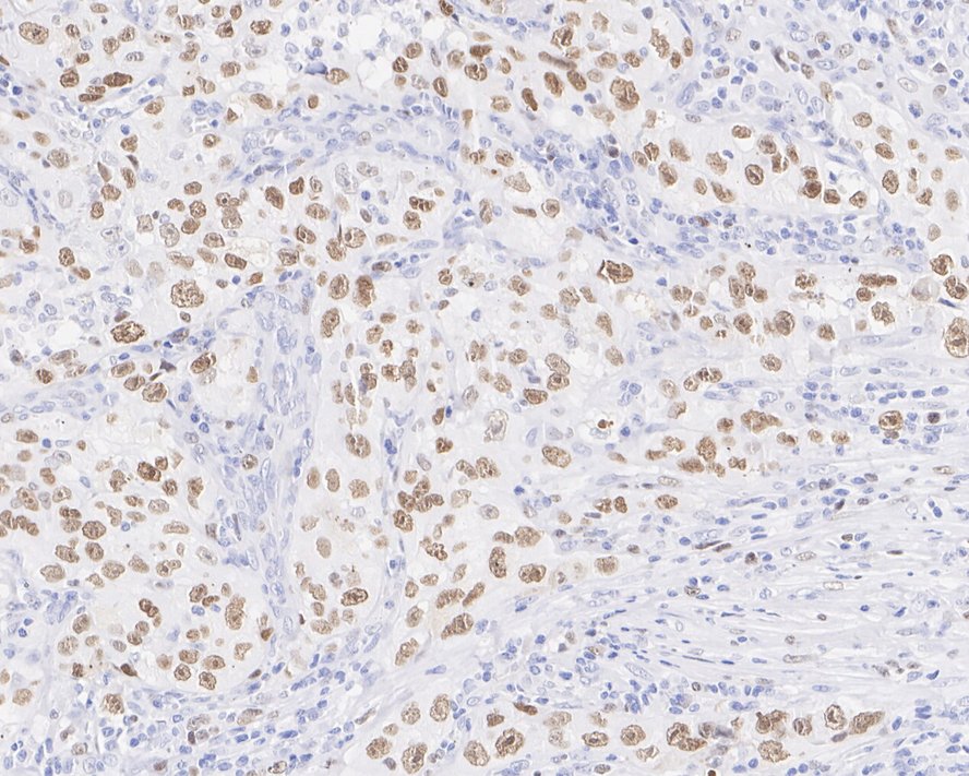 Kif4A Antibody (JE38-91)