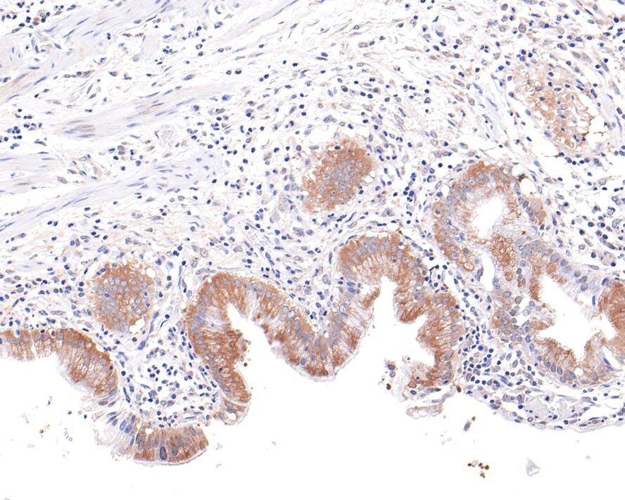 Kinesin 5B Antibody (JE64-16)