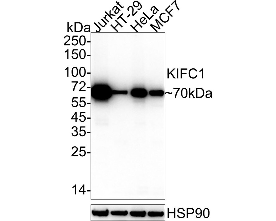 KIFC1 Antibody (JE00-46) Western Blot: KIFC1 Antibody (JE00-46) [NBP3-32504]