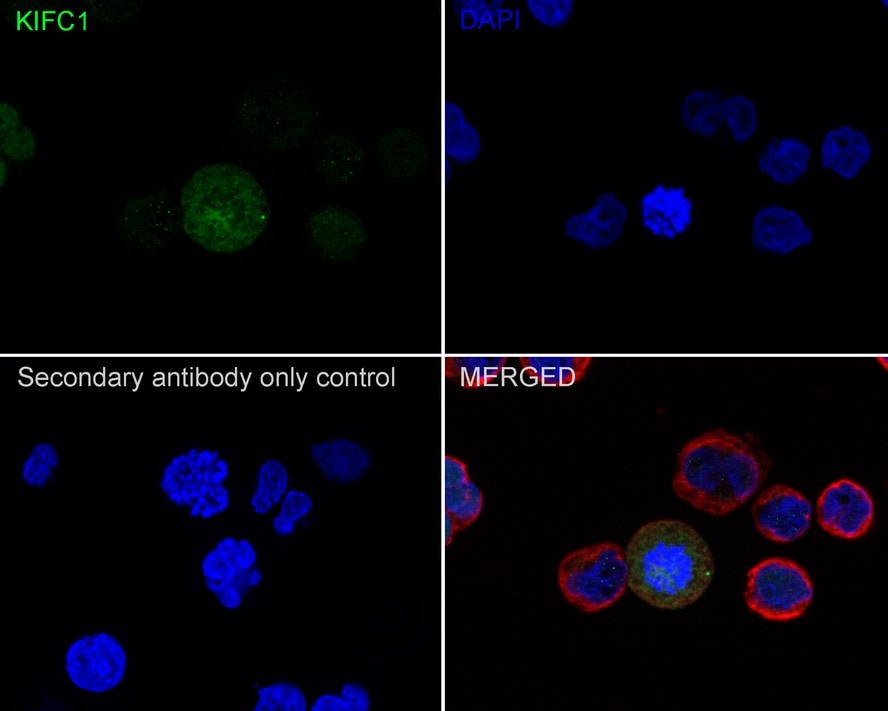 KIFC1 Antibody (JE00-46)