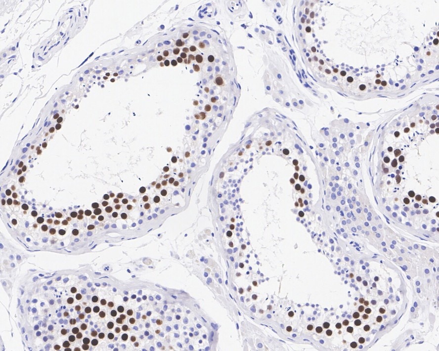 KIFC1 Antibody (JE00-46)