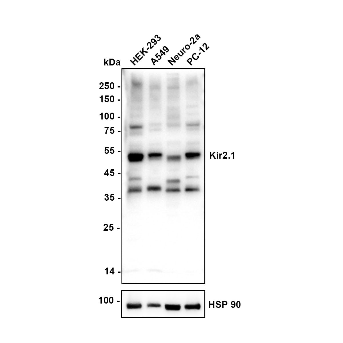 Kir2.1 Antibody (JE54-56) Western Blot: Kir2.1 Antibody (JE54-56) [NBP3-32505]