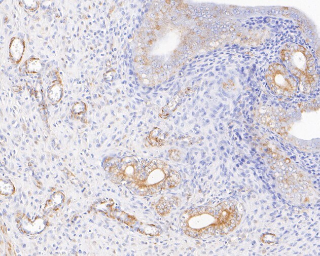 Kir2.1 Antibody (JE54-56)