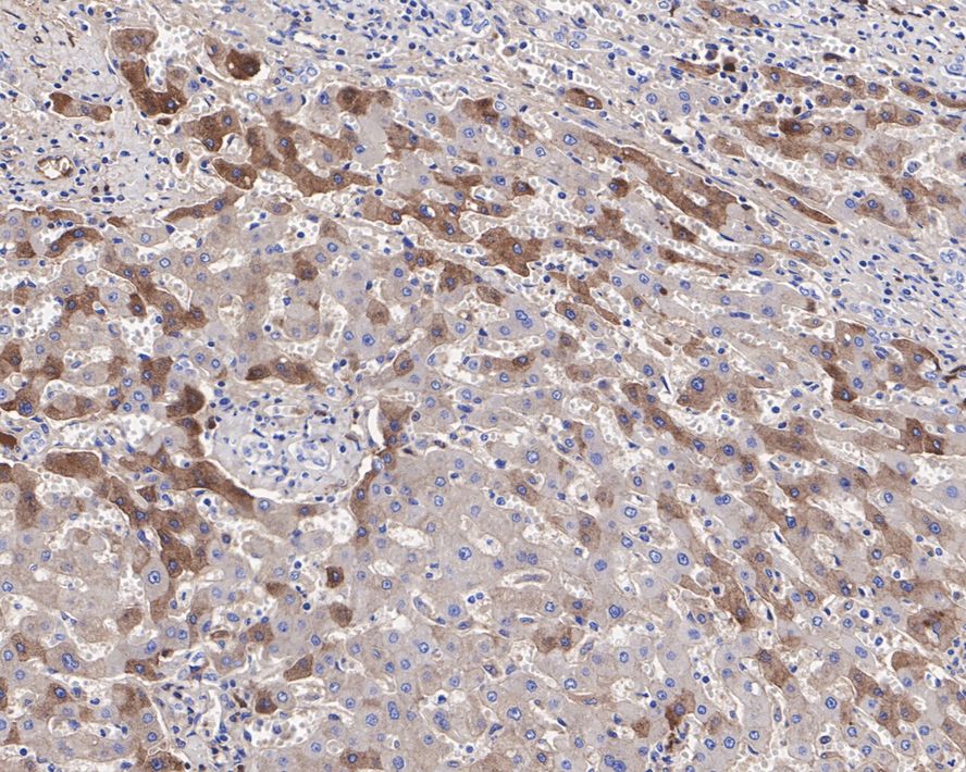 Plasma Kallikrein/KLKB1 Antibody (JE31-29)