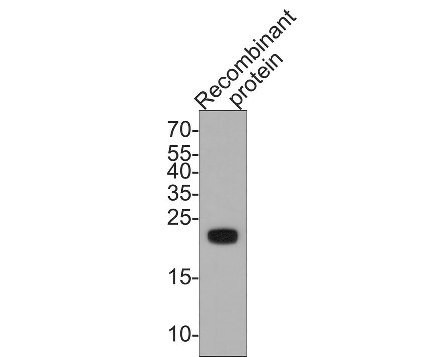 KMT2D Antibody Western Blot: KMT2D Antibody [NBP3-32508]