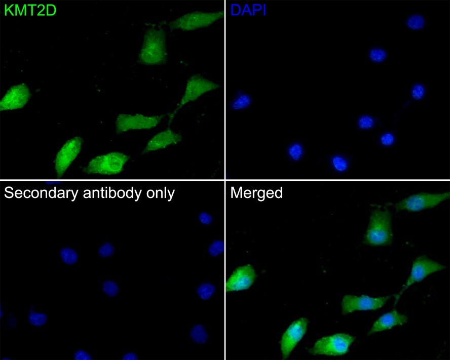 KMT2D Antibody