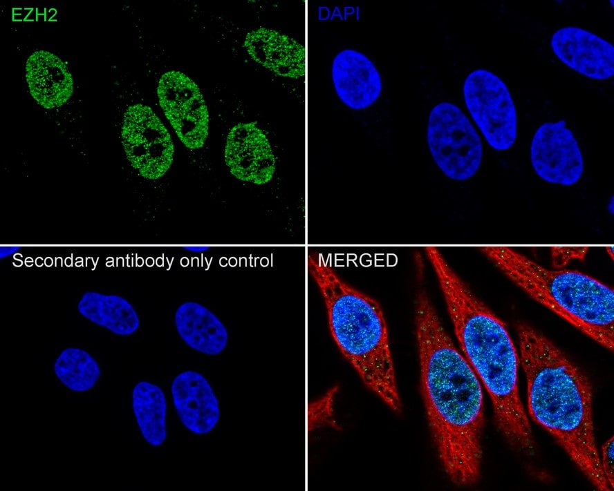 EZH2/KMT6 Antibody (PSH04-14)