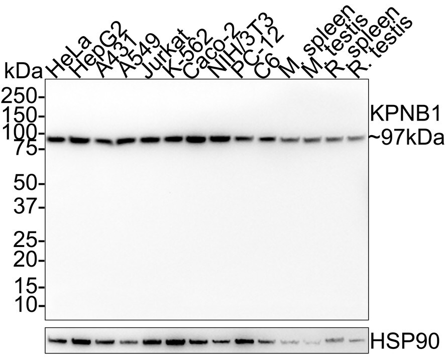 Importin beta/KPNB1 Antibody (PSH01-59) Western Blot: Importin beta/KPNB1 Antibody (PSH01-59) [NBP3-32510]