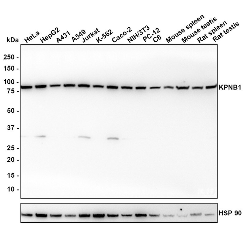 Importin beta/KPNB1 Antibody (PSH01-60) Western Blot: Importin beta/KPNB1 Antibody (PSH01-60) [NBP3-32511]