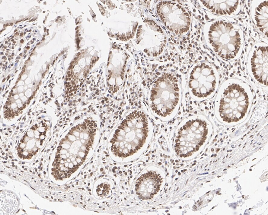Importin beta/KPNB1 Antibody (PSH01-60)