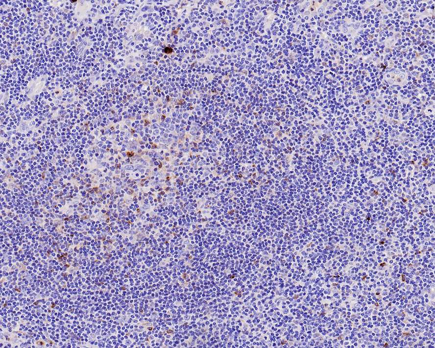 LAG-3 Antibody (PSH0-43)
