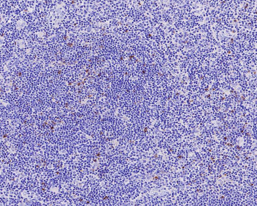 LAG-3 Antibody (PSH0-44)