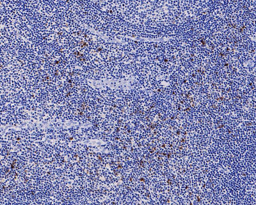 LAG-3 Antibody (PS01-33)