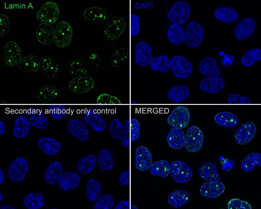 Lamin A + C Antibody (A6F5-R)