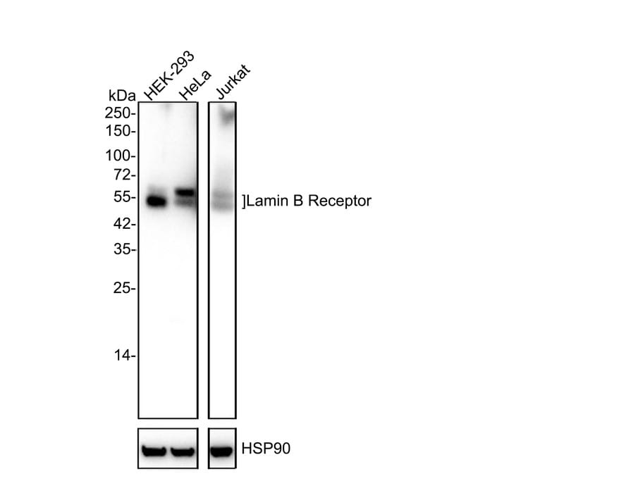 Lamin B Receptor Antibody (PSH02-93) Western Blot: Lamin B Receptor Antibody (PSH02-93) [NBP3-32519]
