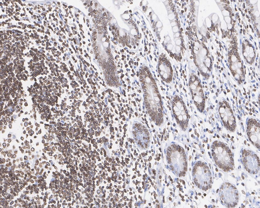 Lamin B Receptor Antibody (PSH02-93)