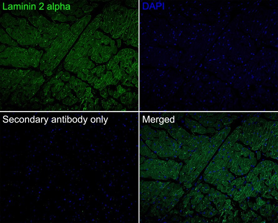 Laminin alpha 2 Antibody (PSH0-94)